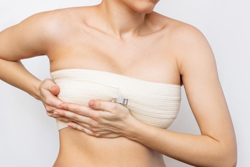 Breast Lift Surgery