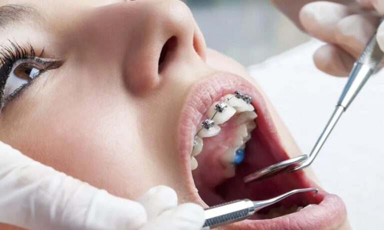 Choosing the Right Dental Provider for Ongoing Oral Care