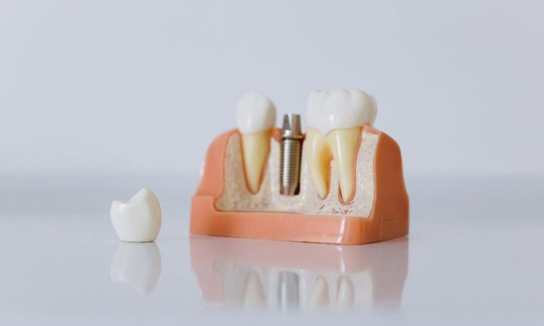 Transforming Smiles with Advanced Cosmetic Dentistry