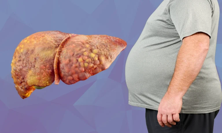 Fatty Liver and Diabetes: Why Metabolic Risk Overlaps